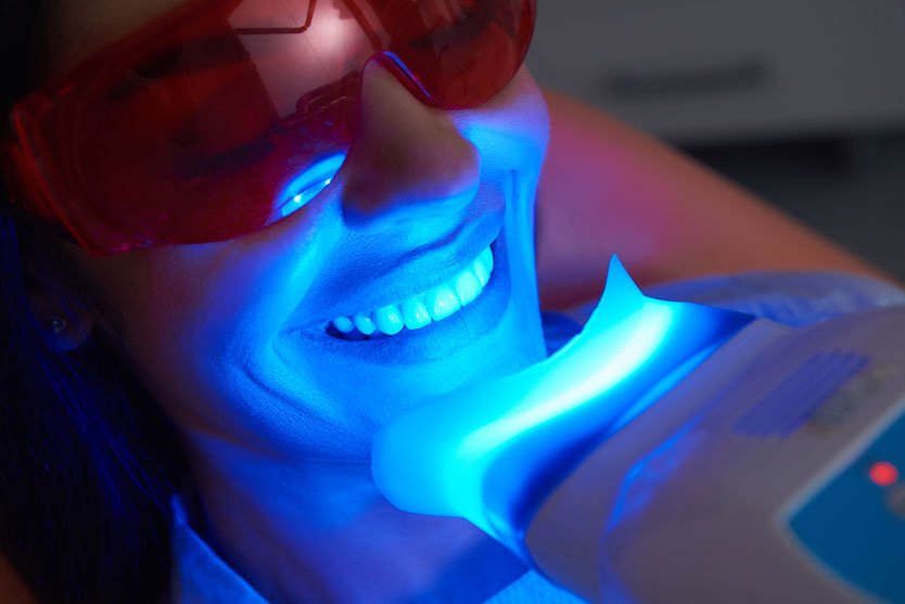 teethwhitening